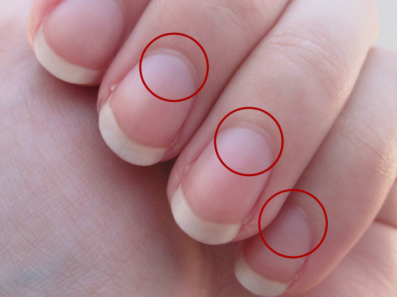 Annotated photo of three fingernails with pale lunula (half-moon) at the base circled