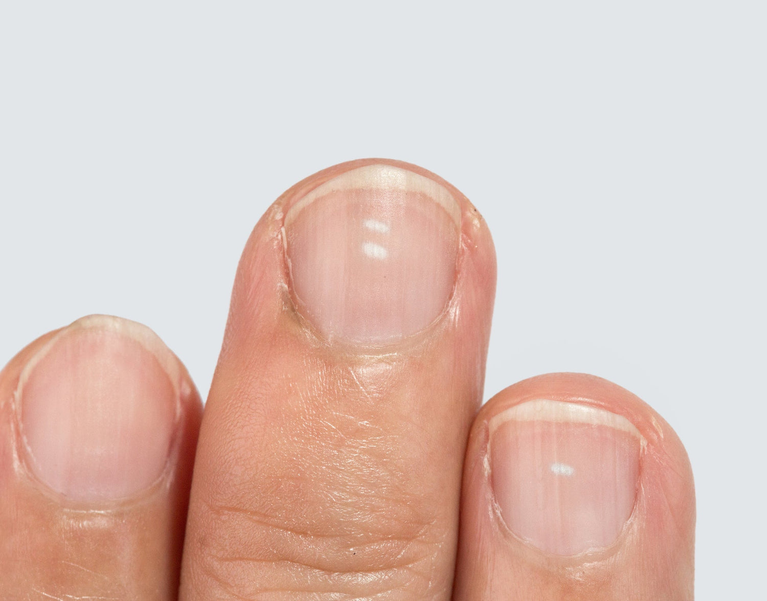 Close-up of three fingernails showing small white spots on the nail plates against a pale gray background