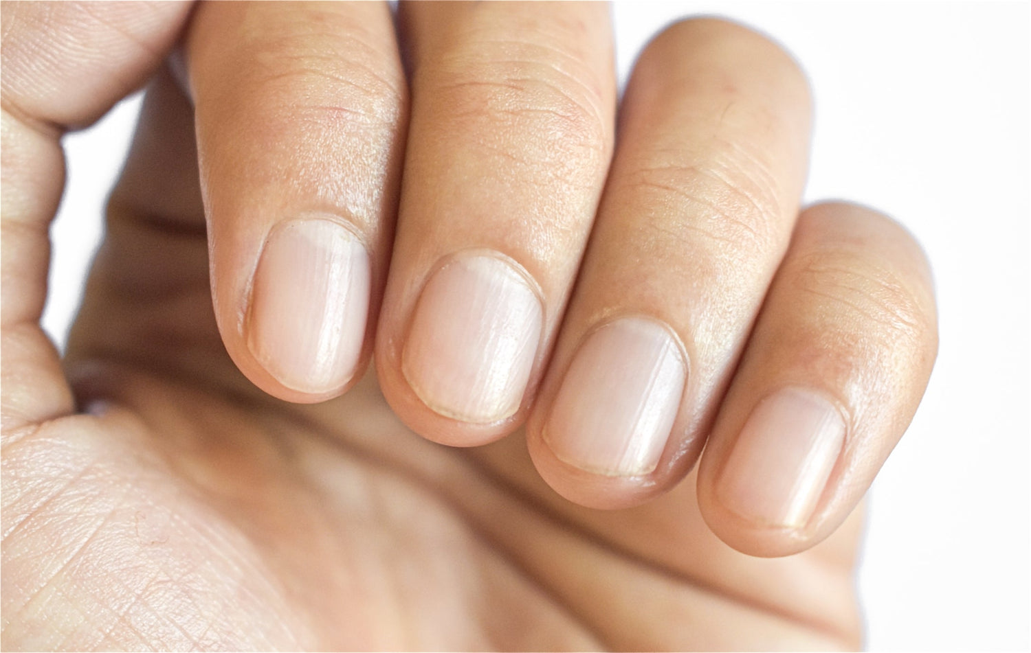 Close-up of four unpolished fingernails showing faint vertical ridges against a light background