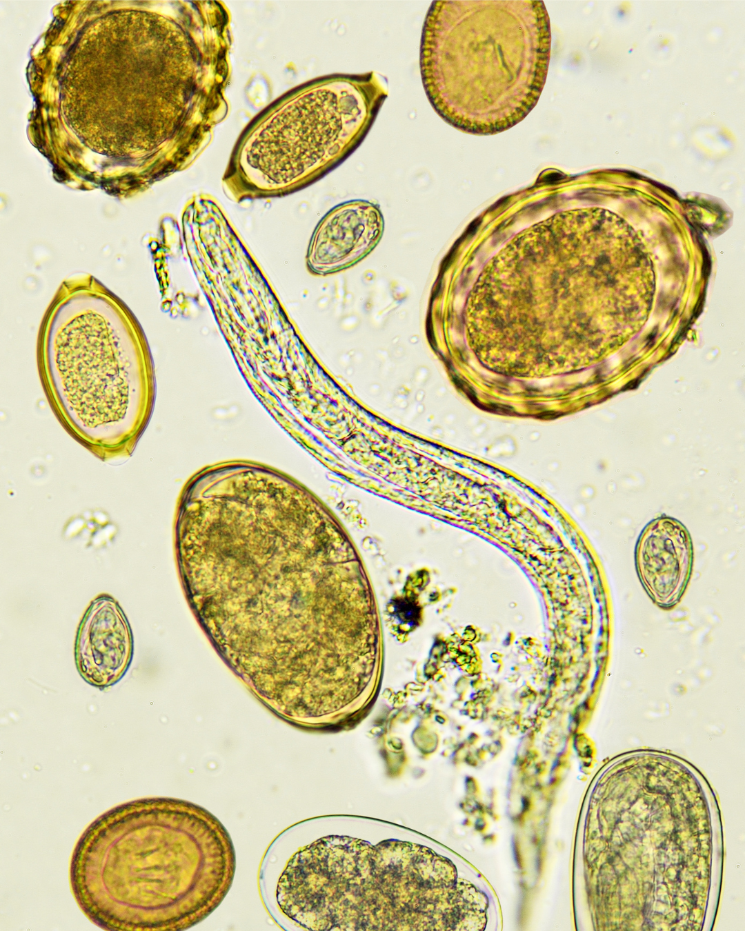 Microscopic view of a thin roundworm surrounded by multiple parasite eggs on a pale background