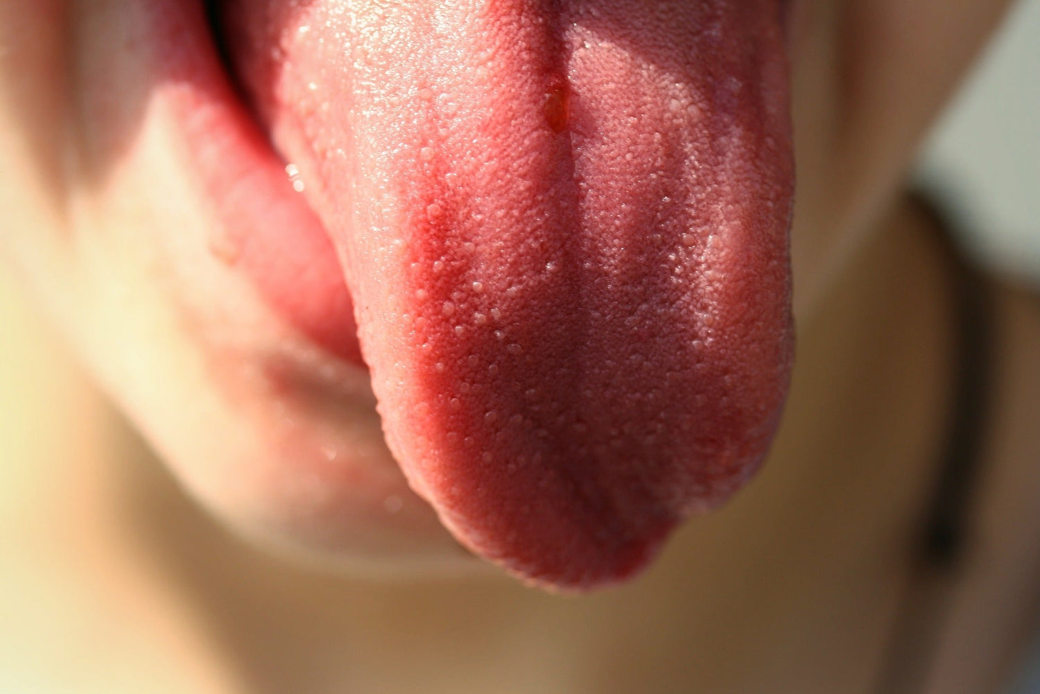 Listen To Your Tongue: What Does a Red Tip Mean in Chinese Medicine?