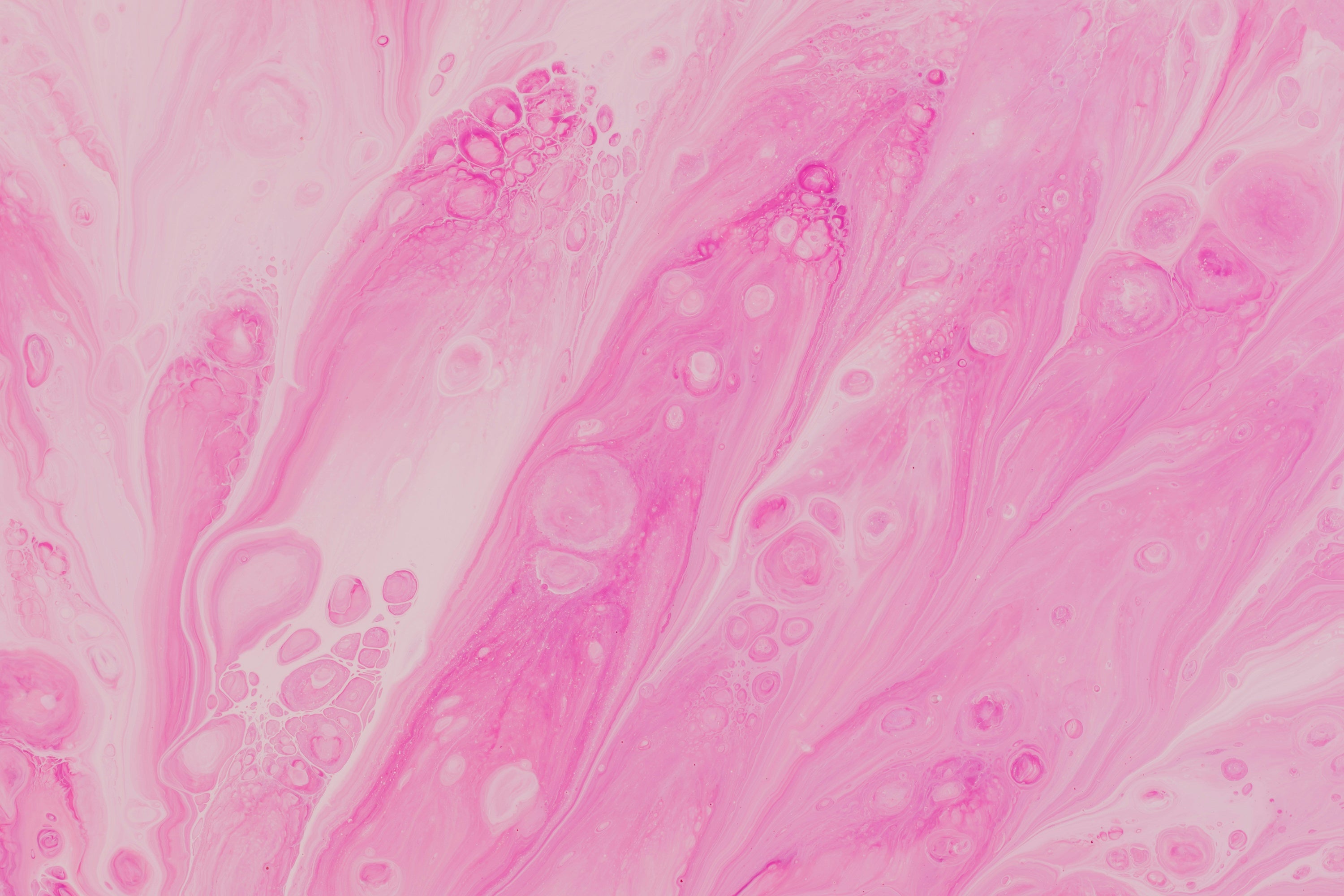 Leaky Gut Explained